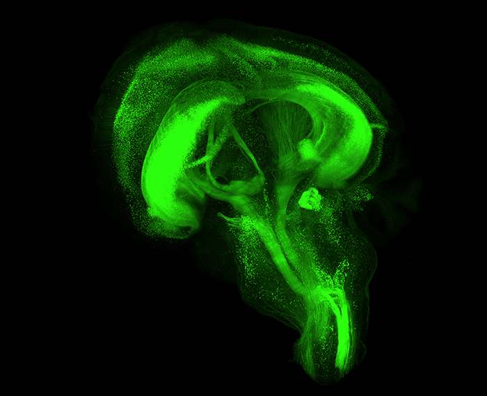 Thy1-driven YFP expression in whole mouse brain, imaged with SmartSPIM