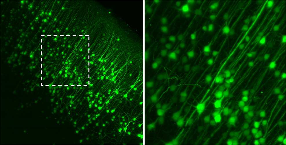 GFP+ motor cortical neurons in whole mouse brain, imaged with SmartSPIM