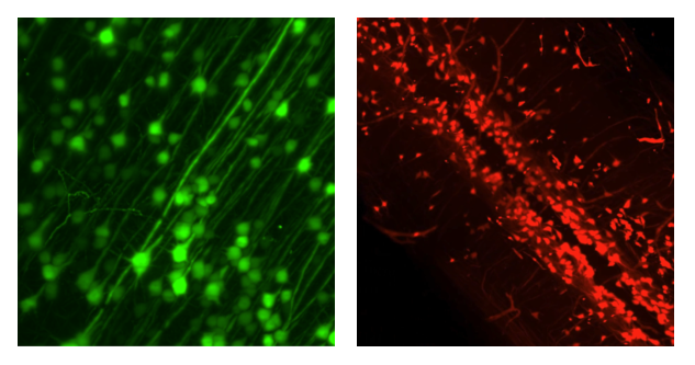 GFP+ motor cortical neurons in whole mouse brain (left) and tdTomato+ in a mouse spinal cord cell-type (right)