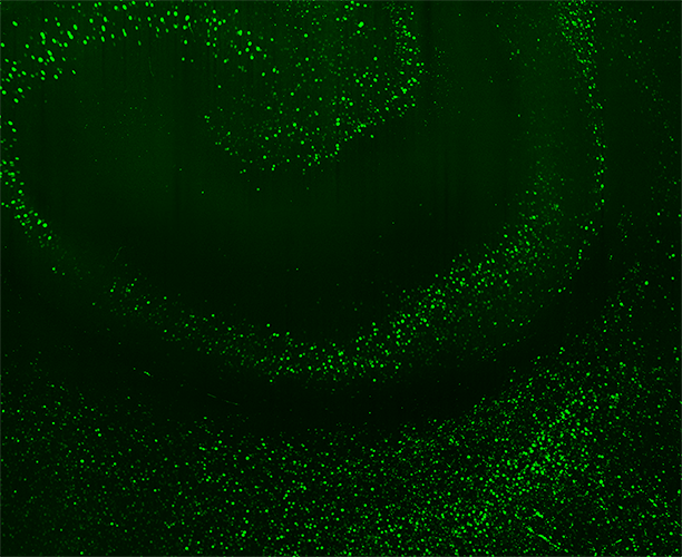 c-FOS expression in whole rat brain, imaged with SmartSPIM and zoomed in
