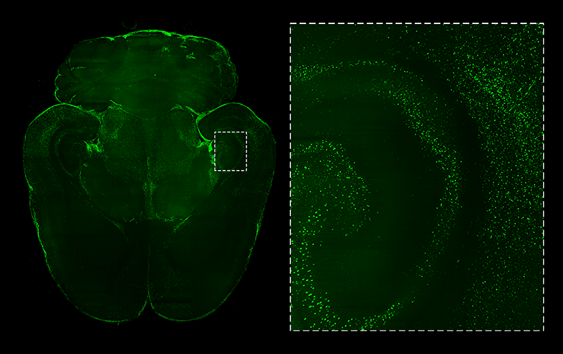 c-FOS expression in whole rat brain, imaged with SmartSPIM
