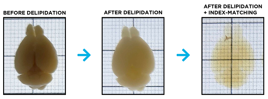 Whole mouse brain before delipidation, after delipidation, and after optical clearing including refractive index matching