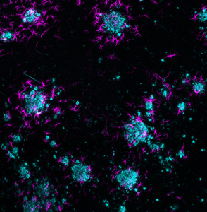 Astrocytes and β-amyloid plaques in intact mouse brain model of Alzheimer's disease, imaged with SmartSPIM light sheet microscope, 15X objective