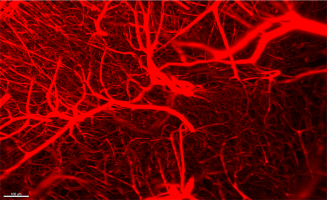 Blood vessels labeled with lectin, imaged with SmartSPIM light sheet microscope, 15x objective