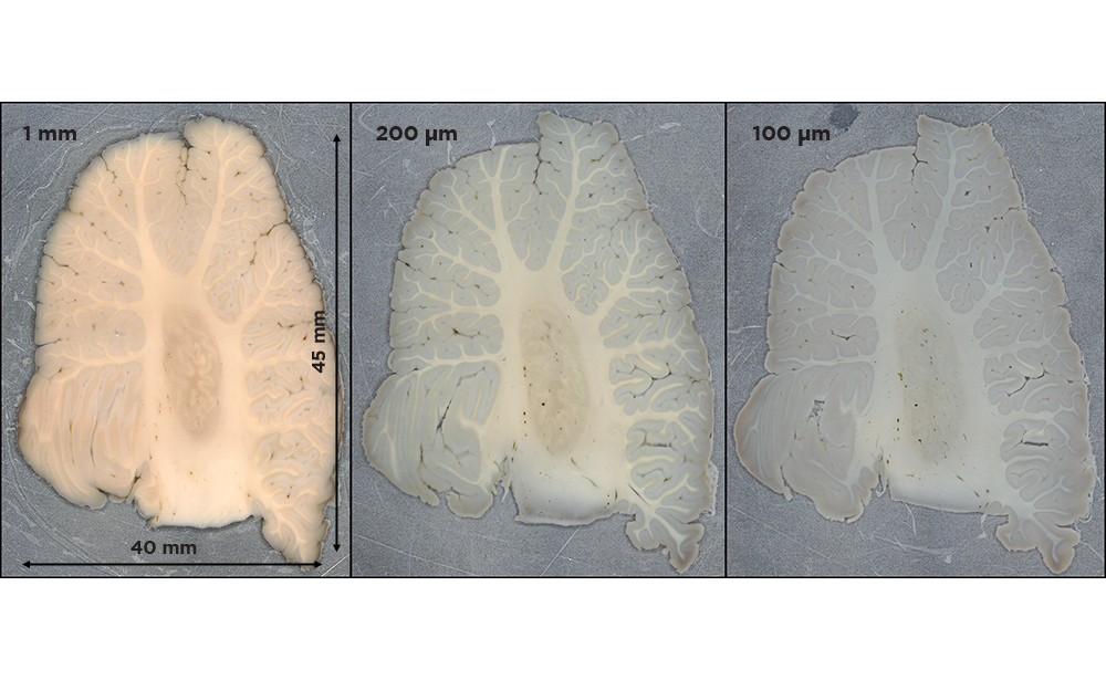Human brain cerebellum sectioned with varying thickness