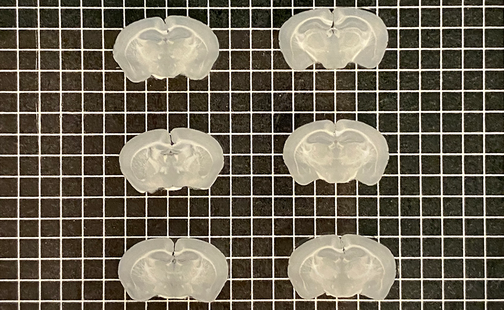 2x3 Mouse brain array sliced into 200 μm sections