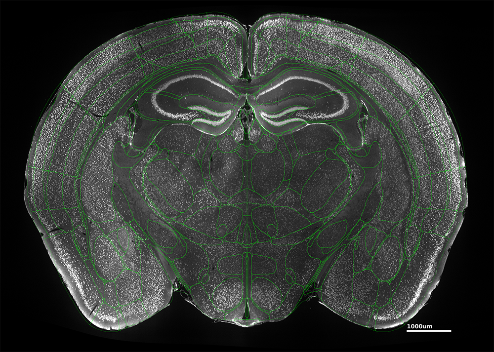 Allen Brain Atlas overlay of NeuN-stained mouse brain
