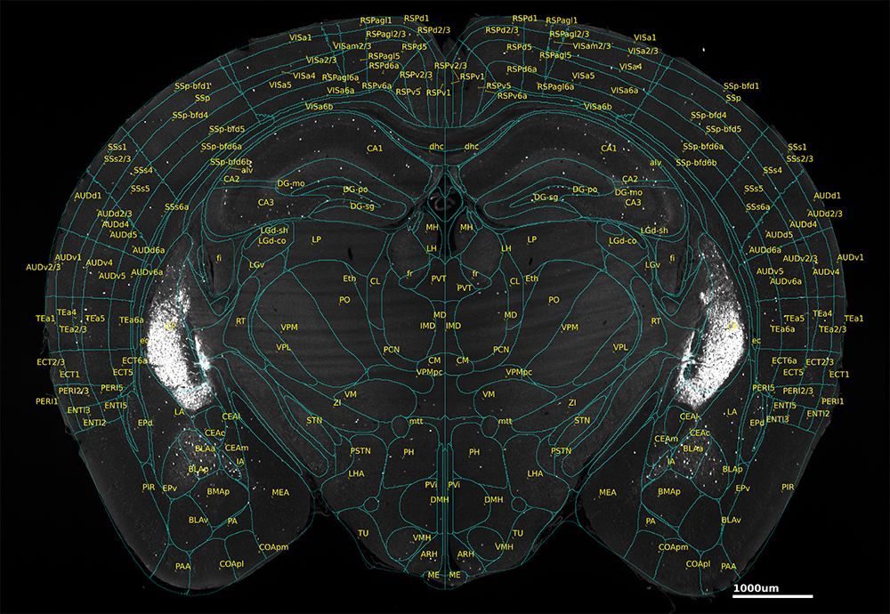 Annotated coronal view of a mouse brain with Allen Brain Atlas overlay