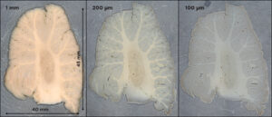 Human brain cerebellum sectioned with varying thickness