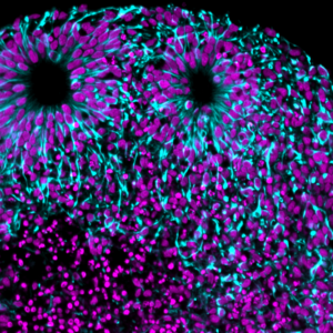 Syto16 and vimentin in intact day 50 dorsal forebrain organoid