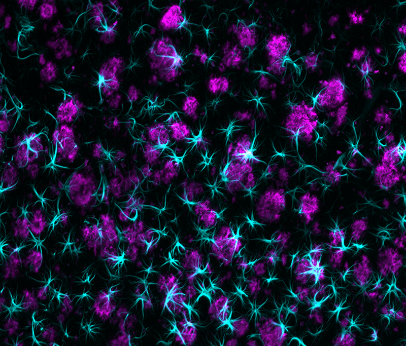 Astrocytes and β-amyloid plaques in 5xFAD whole mouse brain, imaged with SmartSPIM 15x objective