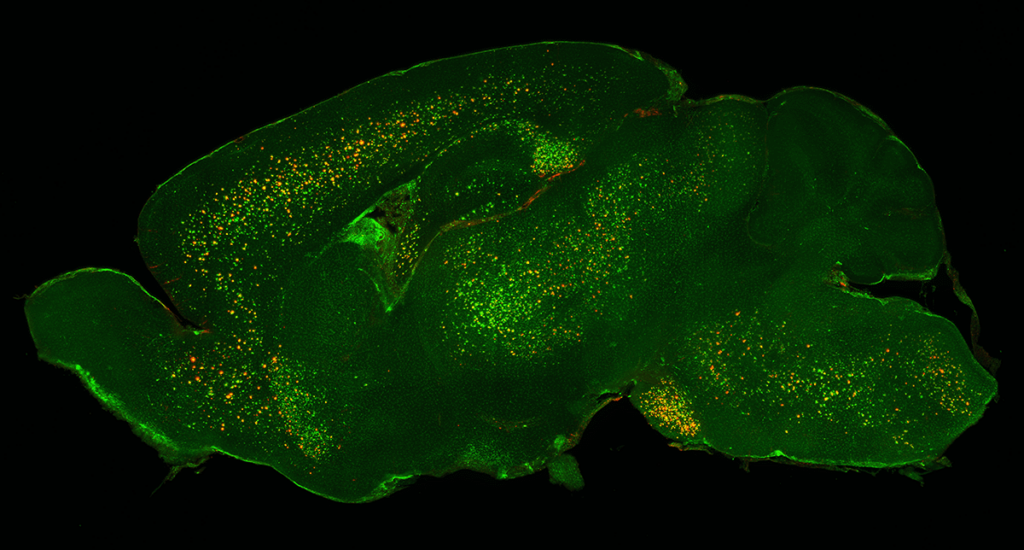 Microglia marked by Iba-1 (red) and Beta-amyloid plaques (green) in a 5xFAD whole mouse brain, sagittal view.