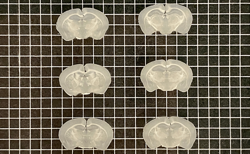 Mouse brains sectioned into 200 µm slices with Megatome.