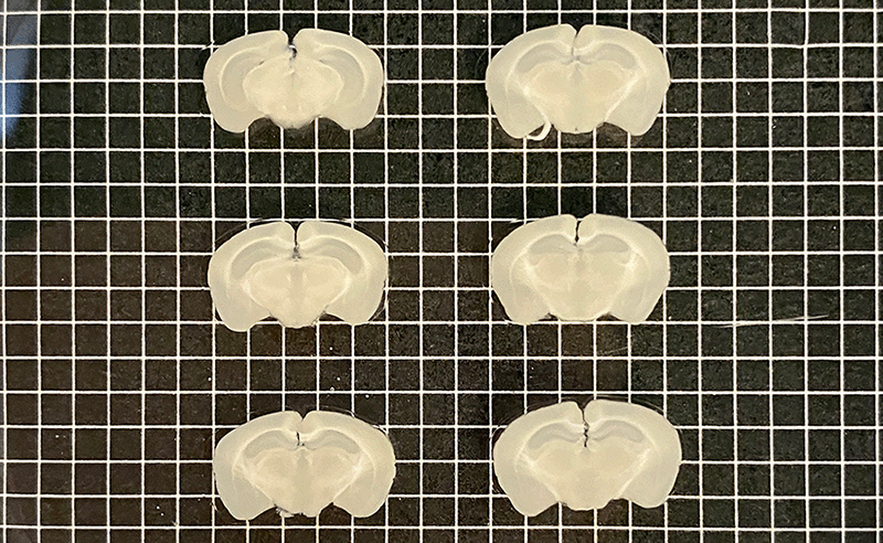 Mouse brains sectioned into 500 µm slices with Megatome.