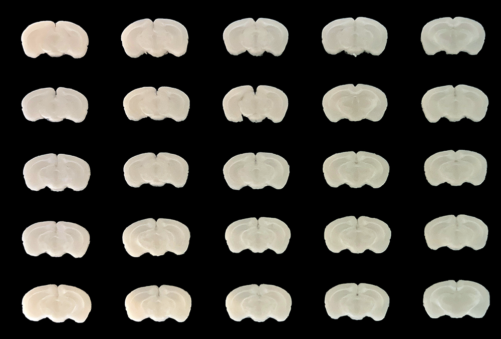 5x5 Mouse brain array sliced into 1 mm sections