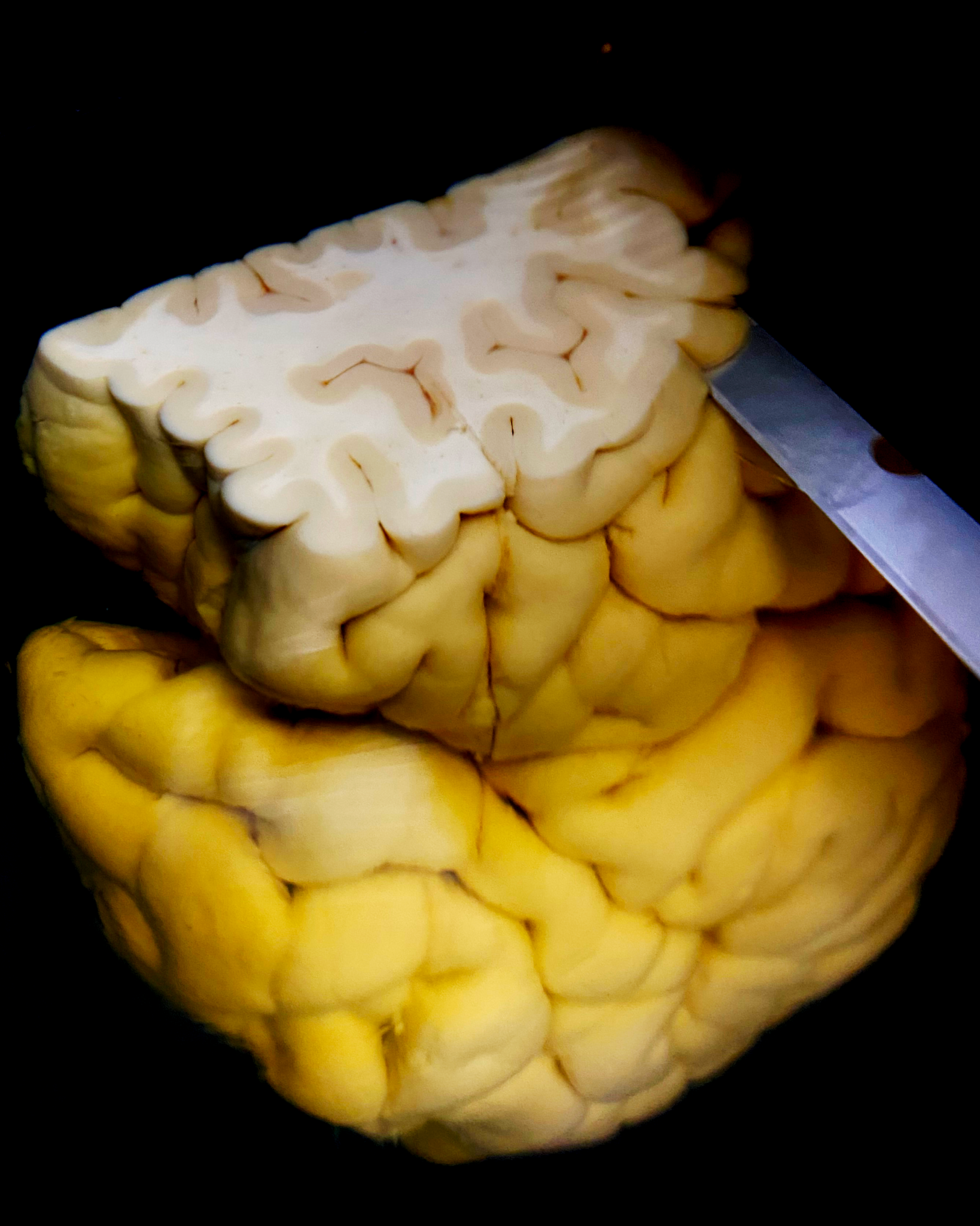 Precision sectioning of human and non-human primate brains with ...