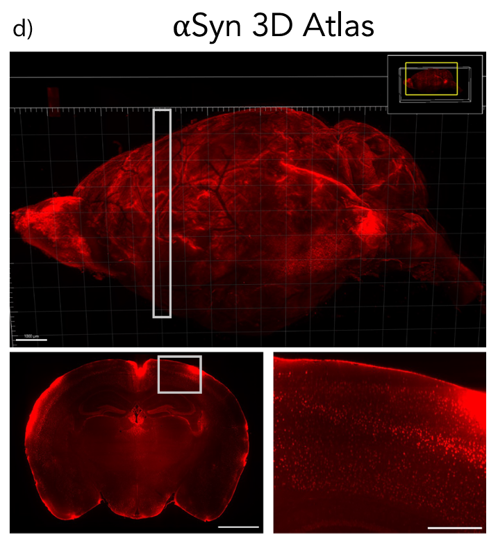 Figure 1d Geertsma et al. NPJ Parkinson's Disease 10, 65 (2024)