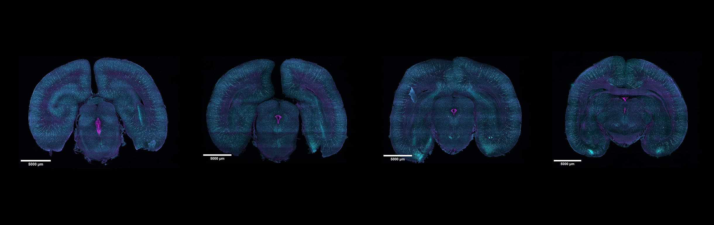 4 1mm marmoset sections imaged with MegaSPIM