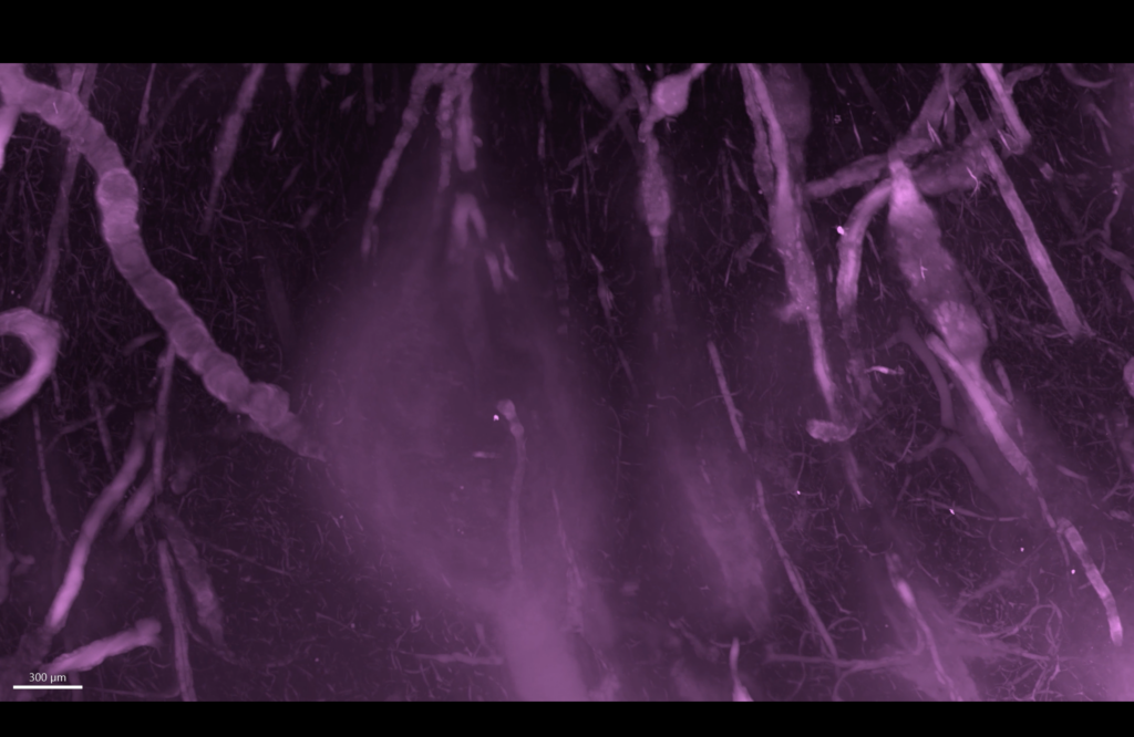 Characterize blood vessels in healthy and diseased states - LifeCanvas ...