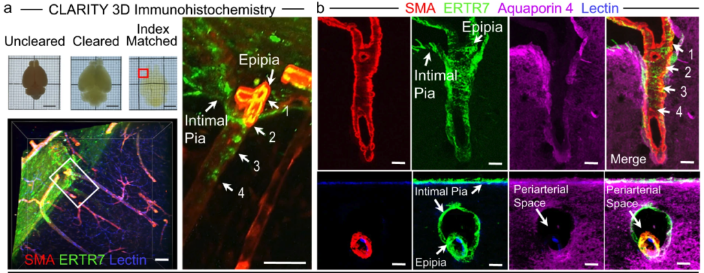 Characterize blood vessels in healthy and diseased states - LifeCanvas ...